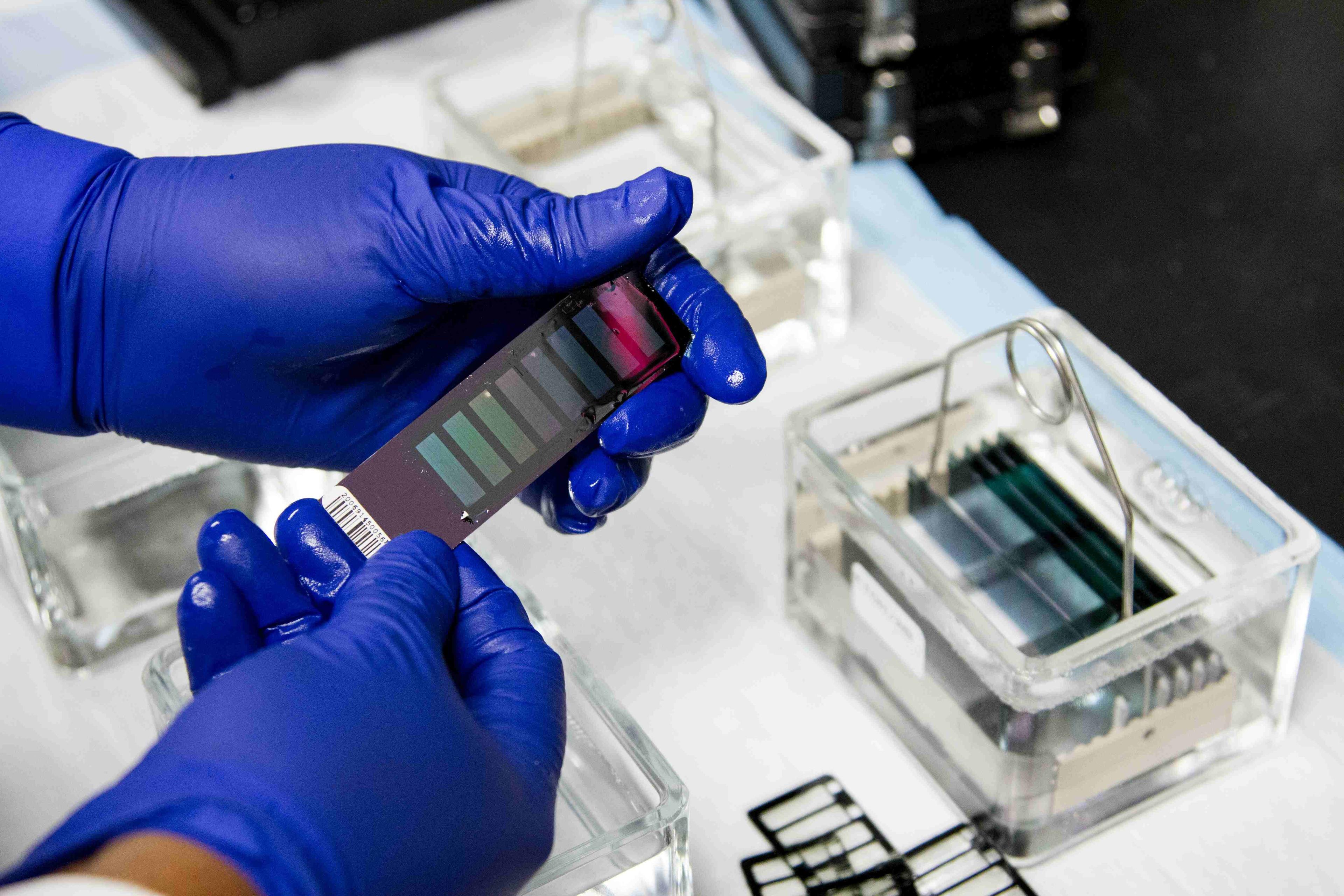 Cancer Genetic Testing consultation